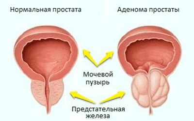Артерии кровоснабжающие предстательную железу тест