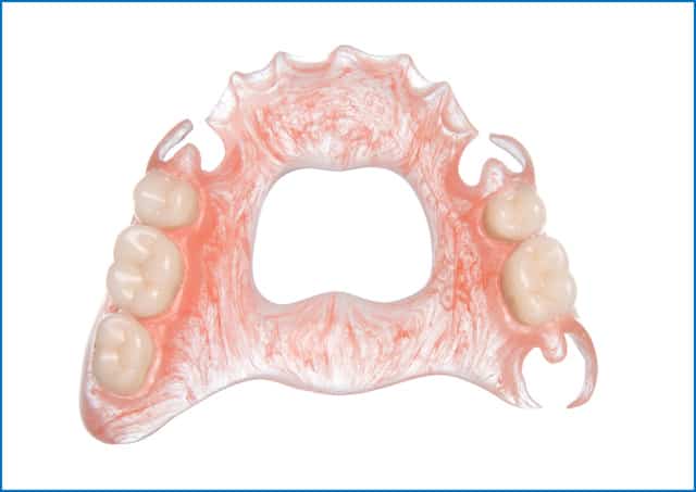 Сплав неблагородных металлов для отливок стоматологический